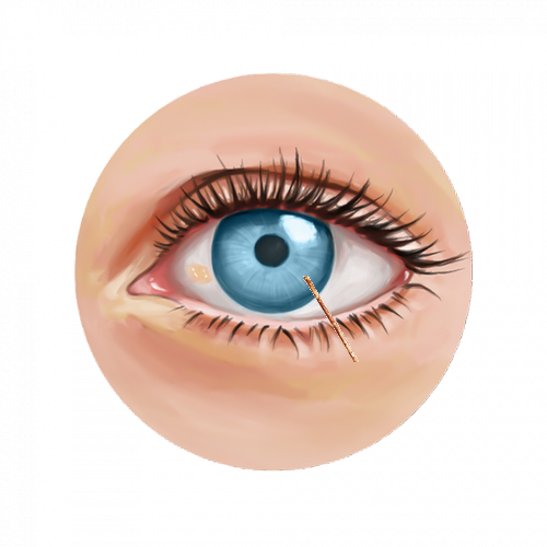 Le petit morceau de bois dans l'œil de son frère 